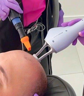 Lavieen (Laser Thulium)